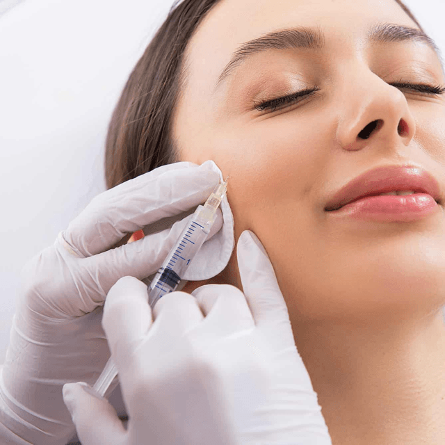 Cheek Filler