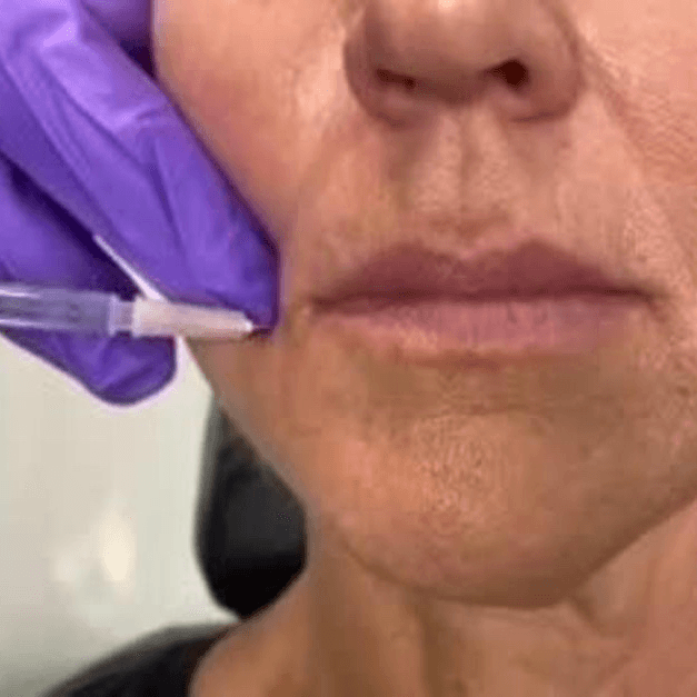 DAO (downward mouth corners)