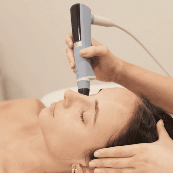 Exion RF Microneedling