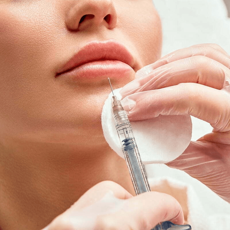 Lip Filler- Builder/Maintenance